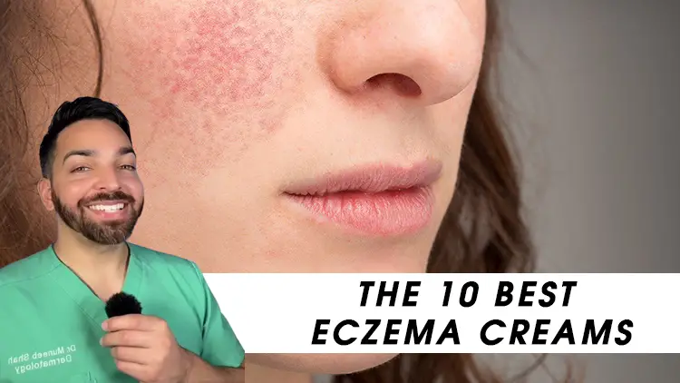 The 10 Best Eczema Creams Of 2023 Tested And Reviewed Recipe Ideas Product Reviews And 1188