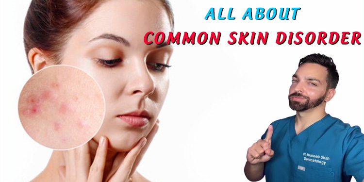 All About Common Skin Disorders Recipe Ideas Product Reviews And