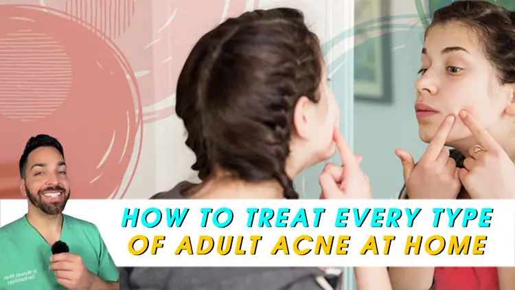How to Treat Every Type of Adult Acne at Home
