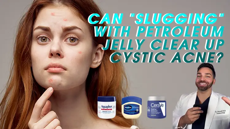 Can “Slugging” With Petroleum Jelly Clear Up Cystic Acne? Experts Weigh In