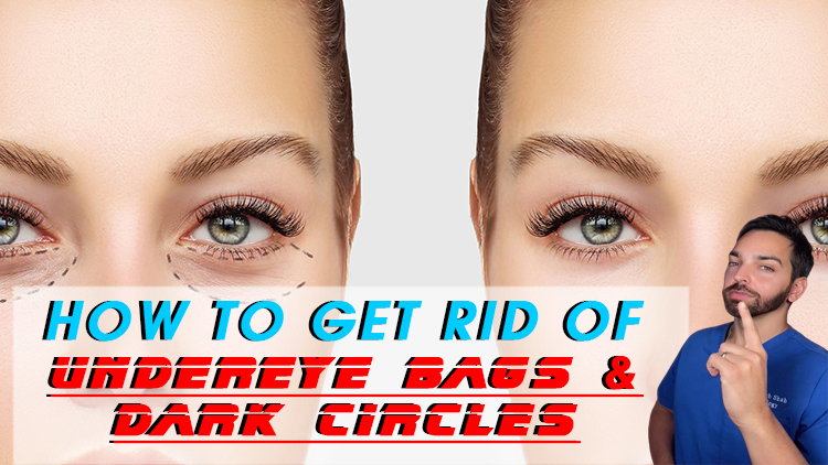 Here’s How to Get Rid of Undereye Bags and Dark Circles to Look More Refreshed