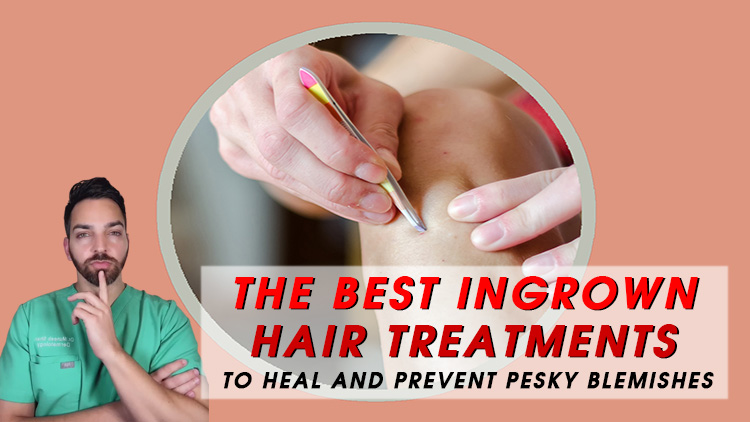 The Best Ingrown Hair Treatments to Heal and Prevent Pesky Blemishes