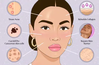 BENEFITS OF CHEMICAL PEELS