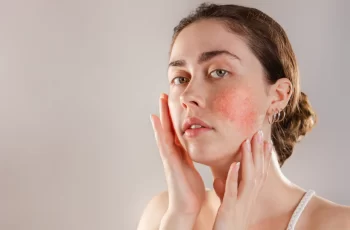 Can you Use Retinol with Rosacea?