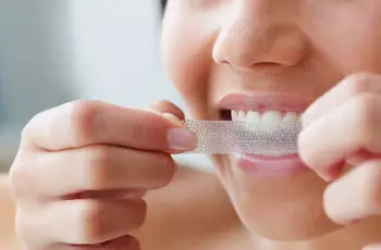 FAQs on Teeth Whitening Strips: How They Work and What to Expect