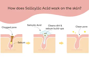 Salicylic Acid for Skincare: What It Does and Why It Works