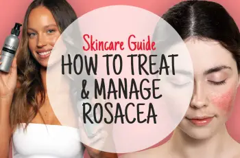 Skincare Ingredients That Can Trigger Rosacea: What to Avoid