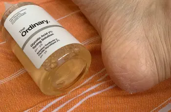 Dry Feet No More: My Secret Glycolic Acid Hack for Summer-Ready Skin