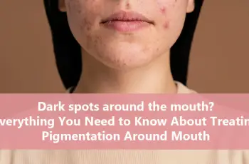 How to Combat Hyperpigmentation Around the Mouth