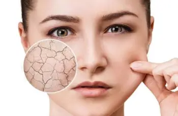 How to Identify if Your Skin is Dry or Just Dehydrated