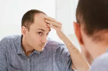 Why Do Men Go Bald? Understanding the Symptoms and Causes