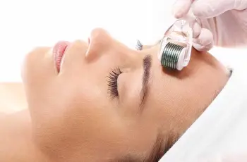 Top 7 Microneedling Rollers for Effective Acne Scar Treatment