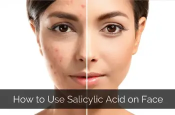 Salicylic Acid Skin Care Benefits – What Makes Salicylic Acid So Good for Your Skin?