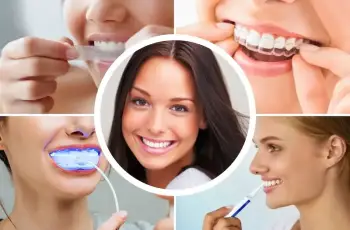 FAQs About Whitening Strips: How to Get a Brighter Smile