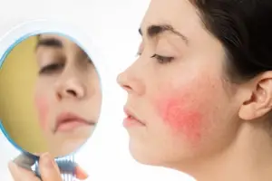 What Ingredients Trigger Rosacea in Skincare Products?