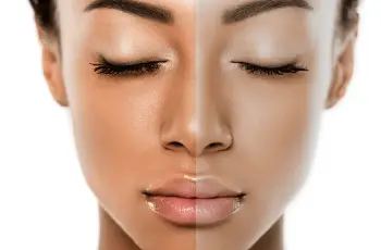 What Factors Contribute to a Dull Skin Tone?