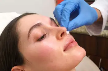 Acne Scar Fillers: Everything You Need to Know About Minimally Invasive Treatments