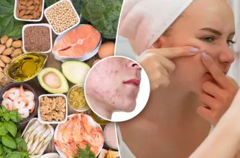 Can Omega-3 and the Mediterranean Diet Clear Your Acne?