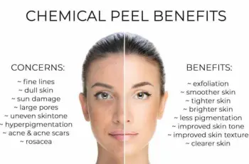 Best Peels for Aging Skin