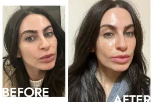 I Tried Glacial Rx—The Newest CryoAesthetic Treatment—And My Skin Has Never Looked Better