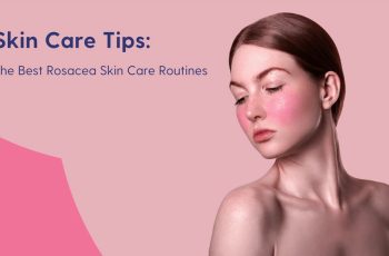 Best Rosacea Skin Care Routine – Tips Dermatologists Recommend