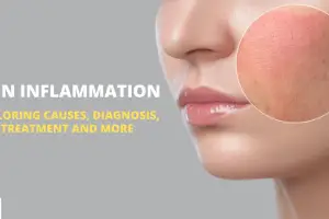 Skin Inflammation: Causes, Diagnosis, Treatment, and More