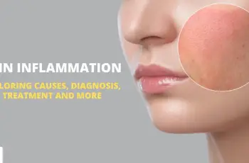 Skin Inflammation: Causes, Diagnosis, Treatment, and More