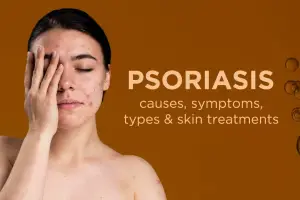 Psoriasis: What It Is, Symptoms, Causes, Types & Treatment