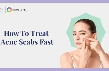 Pimple Scab: How to Heal Acne Scabs