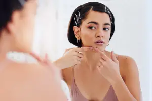 How Salicylic Acid Helps Treat Acne and Improve Skin Clarity