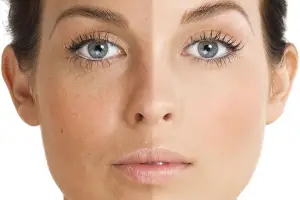 How To Improve Uneven Or Textured Skin