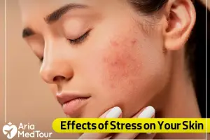 The Effects of Stress on Skin