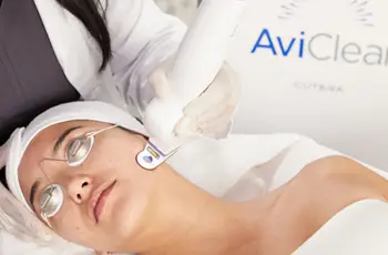I Tried AviClear: A Revolutionary Laser Treatment for Acne—Here’s What Happened