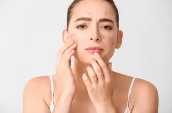 From Acne Despair to Skincare Hope: A Personal Journey From Acne Despair to Skincare Hope: A Personal Journey
