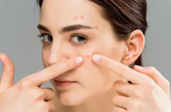 Can Kissing Cause Acne? What Dermatologists Want You to Know Can Kissing Cause Acne? What Dermatologists Want You to Know