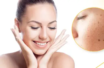 Understanding Hyperpigmentation: Causes, Types, and Effective Treatment Strategies