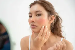 Gentle Skincare Routine to Calm and Protect Rosacea-Prone Skin