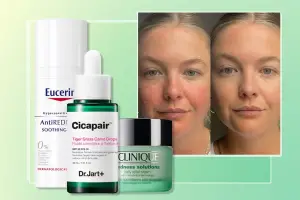 Sensitive Skin Rescue: Rosacea Relief with SkinCeuticals Products