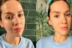 Slugging Trend: Is It Worth Trying for Your Skin Type?