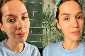 Slugging Trend: Is It Worth Trying for Your Skin Type?