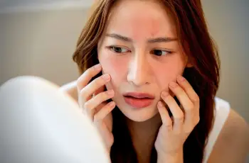 How to Manage a Red Face After Exercising: Tips for Healthier Skin