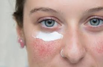 Using Tretinoin and Azelaic Acid Together: Benefits and Tips for Clearer Skin