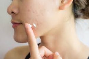 Can You Use Azelaic Acid Daily for Six Months?