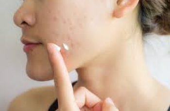 Can You Use Azelaic Acid Daily for Six Months? Can You Use Azelaic Acid Daily for Six Months?