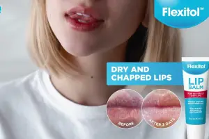 The Best Lip Treatments for Dry, Chapped Lips: Remedies That Really Work