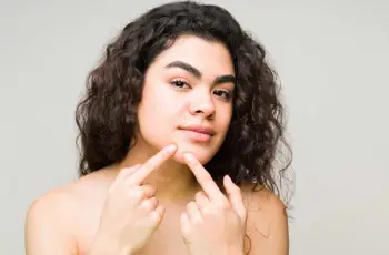 Should I See a Dermatologist for Acne? When and How to Get Professional Help