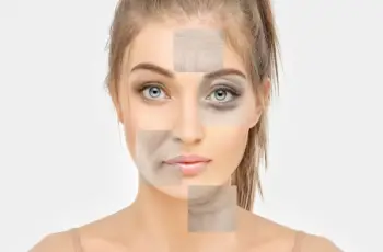 Weight Loss and Your Skin: The Reality of “Ozempic Face” and Effective Treatments