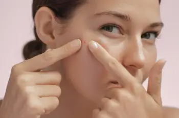 Think You Know Acne? 4 Common Myths Debunked by a Skin Expert Think You Know Acne? 4 Common Myths Debunked by a Skin Expert