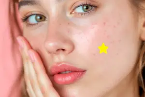 How Azelaic Acid Helps Reduce Rosacea and Redness