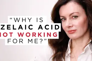 Azelaic Acid Meets Retin-A: Tips for Clearer Skin